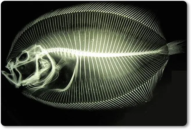 Radiografia del cuerpo de un pez oseo